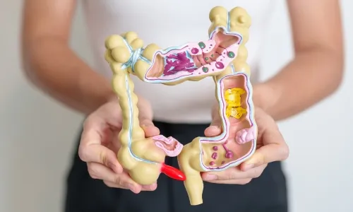 cancer de colon en celaya Oncólogo en Celaya