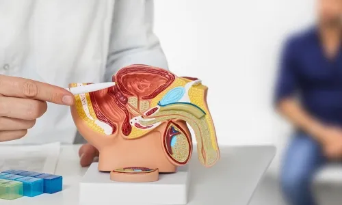 cancer urologico en celaya Oncólogo en Celaya