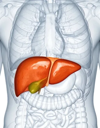 higado Cáncer de Hígado en Celaya