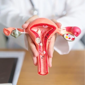 ovario dolor Cáncer de Ovario en Celaya